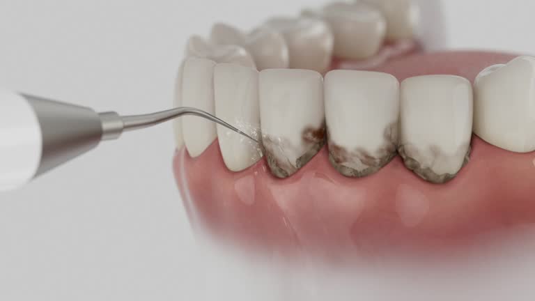 Reliable Dental Implants contractor in Sheridan, IL by Smile Center Dentistry